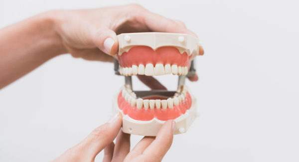 Novo Dental - Dr. Nada - Model Teeth