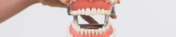 life size model of teeth and jaw