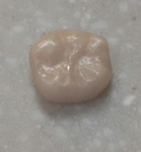 dental ceramic crown