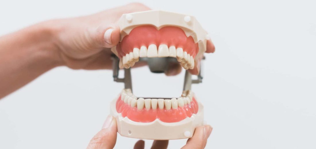 full set of teeth, denture model