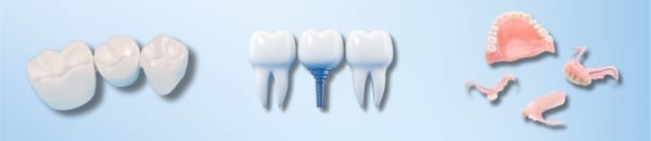 Options for missing teeth